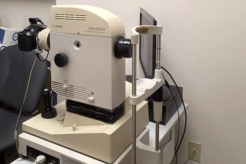 A Canon non-mydriatic retinal camera on its adjustable table, used to photograph the back of the eye.